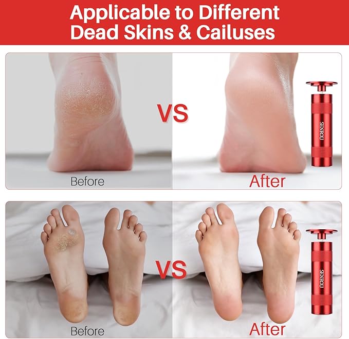 Electric Foot File, Callus Remover for Feet,Adjustable Speed 2 in 1 Electric Foot File Nail Grinder with 60 Pcs Sandpaper Discs, Tool for Dead Skin and Calluses,Gift for Women, Men- Red