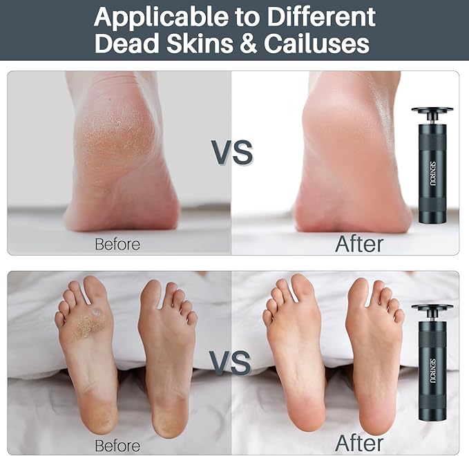 Callus Remover for feet,Nail Filer,Electric Foot Filer with 60Pcs+12Pcs Sandpaper Discs,Gifts for Woman/Men Birthday Christmas Stocking Stuffers Foot Repair Tool-Grey