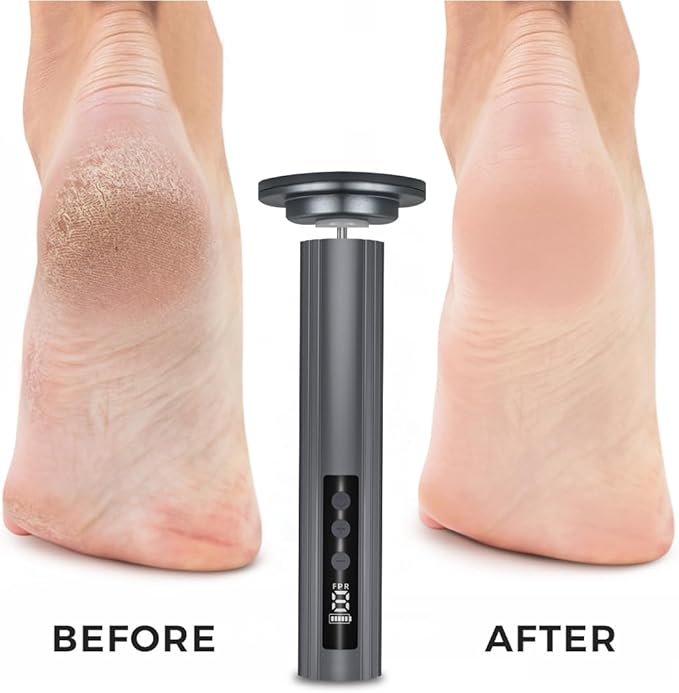 Electric Foot Callus Remover with Nano Glass Head, 9-Speed Rechargeable Foot File with Adjustable R/F Rotation, Digital Display & Powerful Motor for Cracked Heels & Dead Skin (Gray)