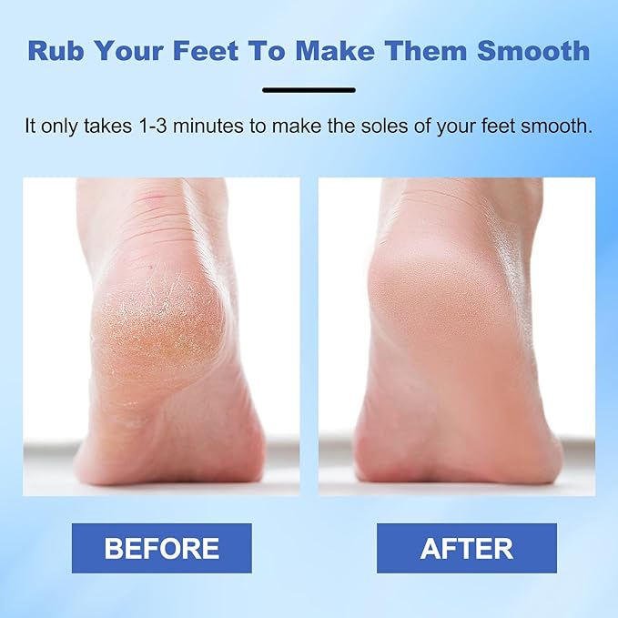 Veinsgrain Foot File, Nano Glass Foot File, Hard Skin Remover Nano-Glass Feet File, Professional Foot Care Tools, Pedicure Tool for Smooth Feet -Gold