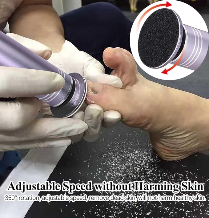 Upgraded Electric Callus Remover for Feet 1200rpm, Adjustable Speed Professional Electric Foot Sander Foot Filer Women Men Pedicure Tools for Feet Callus Remover, FCR-2 Gray