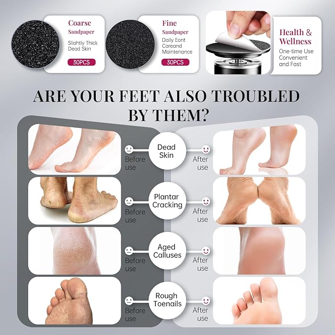 krofaue 1000RPM Electric Callus Remover - Professional Aluminum Foot File Adjustable Pedicure Tool with 60pcs Sandpaper Discs for Dead Skin at Home