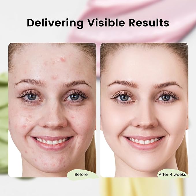 Turmeric Clay Mask, Rose Face Mask & Green Tea Mud Mask 12 PCS - Spa Facial Mask Set Gift for Women & Men, Skin Care Set for Deep Cleansing, Moisturizing, and Refining Pores,Travel-Friendly & Portable