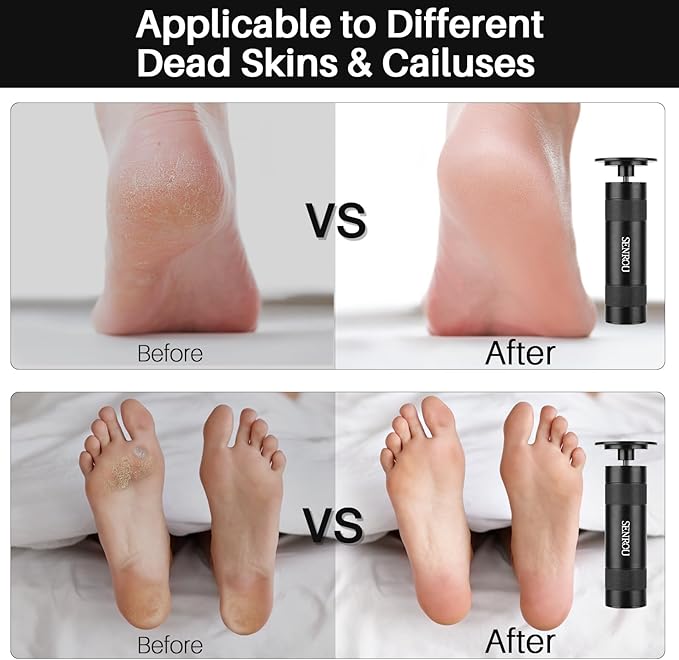 Electric Foot Callus Remover, 2-in-1 Electric Foot Filer/Nail Filer, Callus Remover for Feet with 60Pcs+12Pcs Sandpaper Discs，Holiday Gift Foot Repair Tool, Black