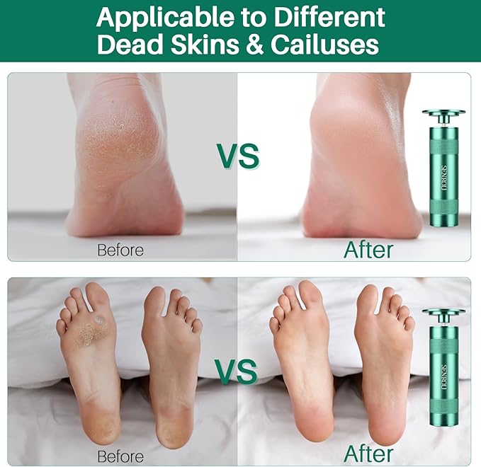 Electric Foot Callus Remover, 2-in-1 Electric Foot Filer/Nail Filer, Callus Remover for Feet with 60Pcs+12Pcs Sandpaper Discs，Holiday Gift Foot Repair Tool, Green